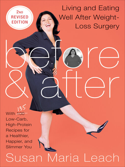 Title details for Before & After by Susan Maria Leach - Wait list
